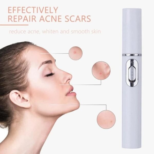 Blue Light Therapy Acne Laser Pen Soft Scar Wrinkle Removal Treatment Device Skin Care Beauty Equipment - Image 7