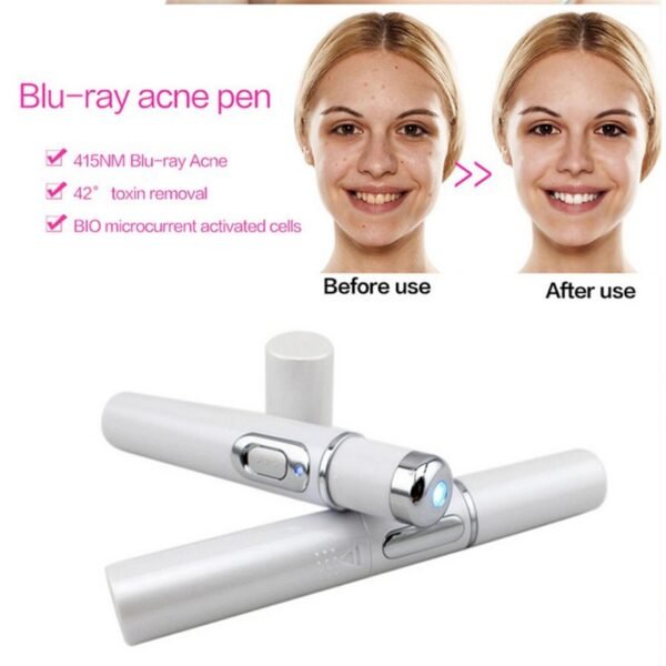 Blue Light Therapy Acne Laser Pen Soft Scar Wrinkle Removal Treatment Device Skin Care Beauty Equipment - Image 8